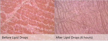 Lipid Drops 30ML Tester