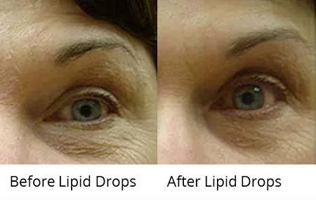 Lipid Drops 30ML Tester